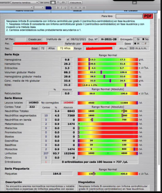 Software MAX IV interfaz antigua